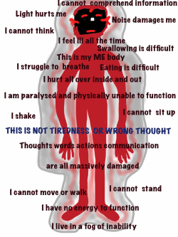 a drawing of an ME Body showing the pain and suffering
