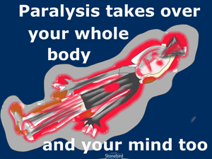 a poster saying how paralysis takes over your whole body