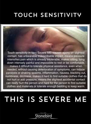 a poster listing the many symptoms of touch sensitivity in Severe ME
